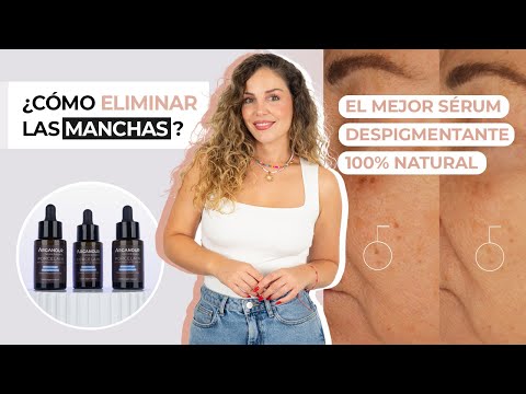 como eliminar las manchas de la piel