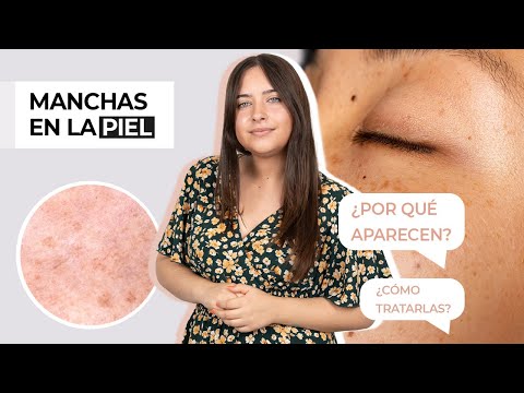 causas de las manchas en la piel